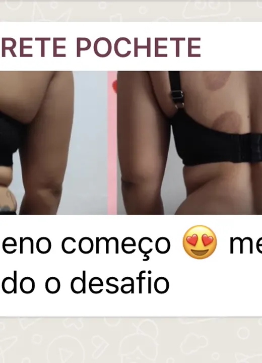 Resultado real de aluno — antes e depois