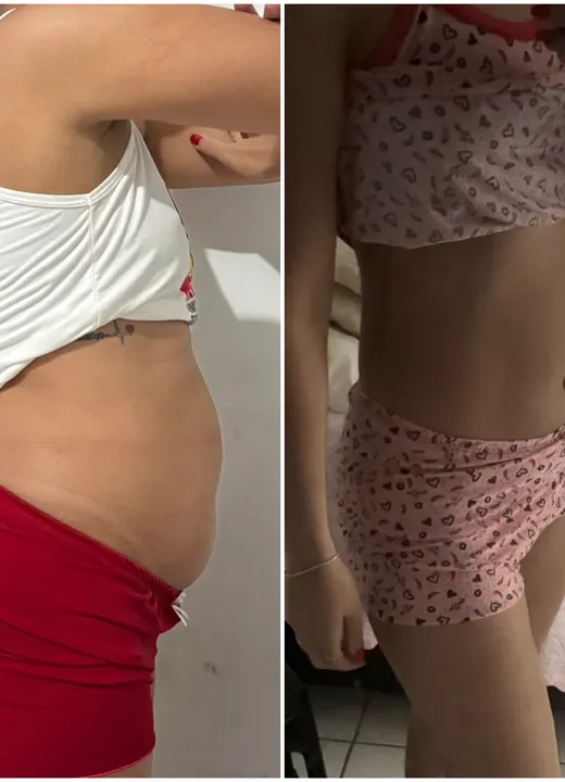 Resultado real de aluno — antes e depois