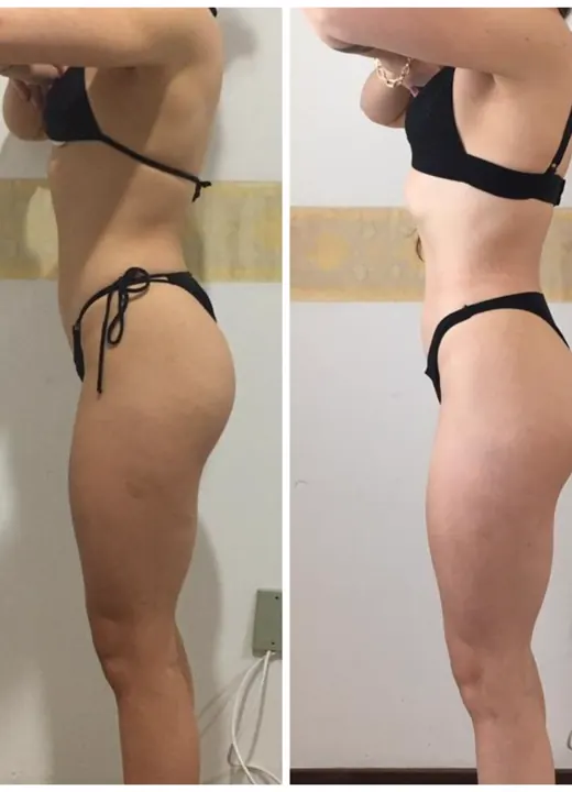 Resultado real de aluno — antes e depois