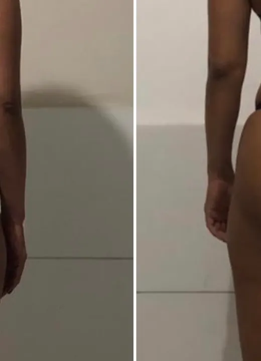 Resultado real de aluno — antes e depois