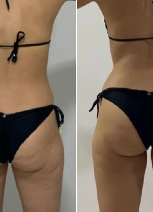 Resultado real de aluno — antes e depois